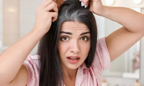कम उम्र में सफेद हो रहे बाल? जीन, तनाव और खानपान हैं इसके कारण कम उम्र में सफेद हो रहे बाल? जीन, तनाव और खानपान हैं इसके कारण