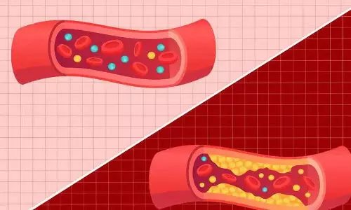 HDL और LDL क्या हैं और हमें उन्हें कैसे कंट्रोल करना चाहिए?