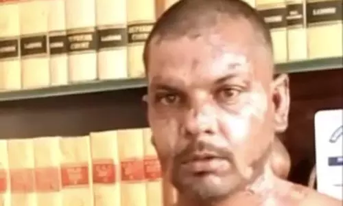 पाकिस्तान में ईसाई व्यक्ति पर बर्बर हमला, अधिकार समूह ने की कड़ी निंदा पाकिस्तान में ईसाई व्यक्ति पर बर्बर हमला, अधिकार समूह ने की कड़ी निंदा