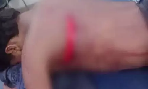 नाबालिग पर चाकू से हमला, क्रिकेट में हारे पैसों को लेकर हुआ था विवाद