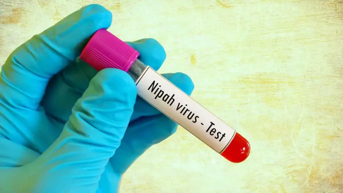 Nipah virus: फैक्ट्स, लक्षण और मौजूदा रिस्क लेवल Nipah virus: फैक्ट्स, लक्षण और मौजूदा रिस्क लेवल