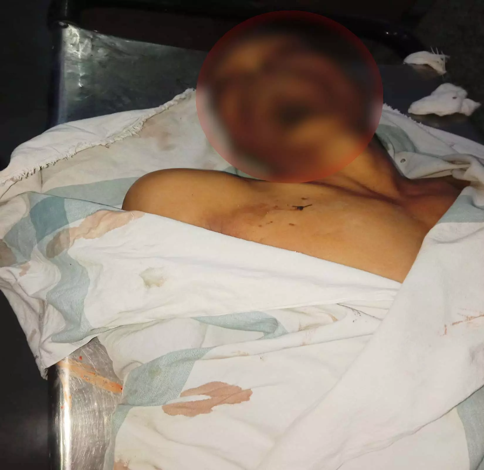 दुर्गेश ध्रुव हत्याकांड: दो आरोपी हिरासत में, चाकूबाजी से हुई थी हत्या दुर्गेश ध्रुव हत्याकांड: दो आरोपी हिरासत में, चाकूबाजी से हुई थी हत्या