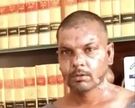 पाकिस्तान में ईसाई व्यक्ति पर बर्बर हमला, अधिकार समूह ने की कड़ी निंदा पाकिस्तान में ईसाई व्यक्ति पर बर्बर हमला, अधिकार समूह ने की कड़ी निंदा