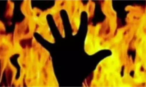 Mp News:  ई-ट्राइसाइकिल की बैटरी ब्लास्ट, जिंदा जला दिव्यांग शिक्षक