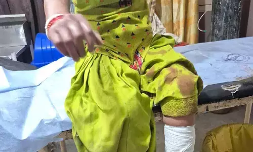 Jalandhar: अर्बन एस्टेट में कुत्तों ने आतंक मचाया, नए साल से अब तक 40 मामले Jalandhar: अर्बन एस्टेट में कुत्तों ने आतंक मचाया, नए साल से अब तक 40 मामले