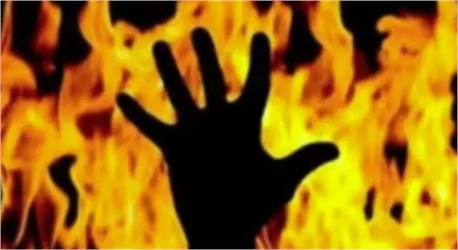 Mp News: ई-ट्राइसाइकिल की बैटरी ब्लास्ट, जिंदा जला दिव्यांग शिक्षक Mp News: ई-ट्राइसाइकिल की बैटरी ब्लास्ट, जिंदा जला दिव्यांग शिक्षक