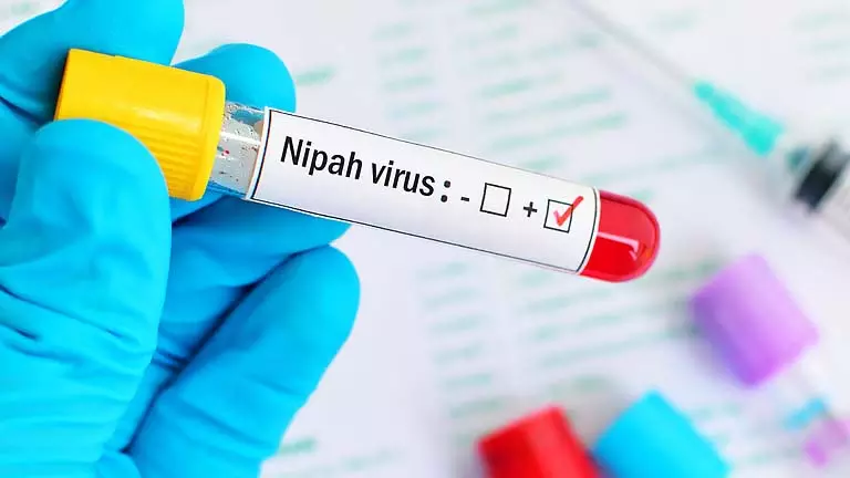 Nipah से संक्रमित पुरुष नर्स को डिस्चार्ज कर दिया गया, संक्रमण का खतरा कम Nipah से संक्रमित पुरुष नर्स को डिस्चार्ज कर दिया गया, संक्रमण का खतरा कम