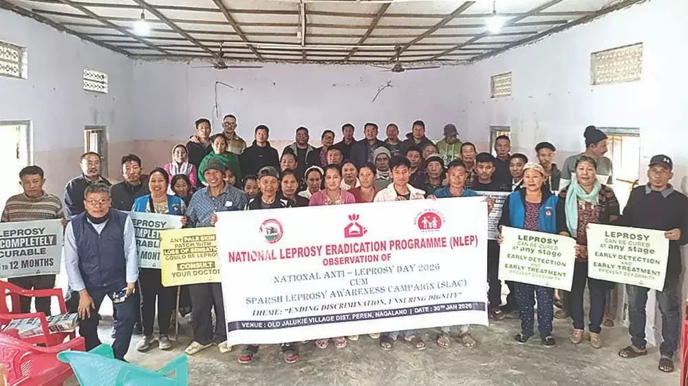 Nagaland : ओल्ड जलुकी में कुष्ठ रोग विरोधी दिवस मनाया गया Nagaland : ओल्ड जलुकी में कुष्ठ रोग विरोधी दिवस मनाया गया