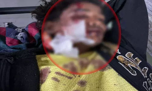 रायपुर ग्रामीण इलाके में 2 बाइकों में टक्कर, 18 वर्षीय युवक घायल रायपुर ग्रामीण इलाके में 2 बाइकों में टक्कर, 18 वर्षीय युवक घायल