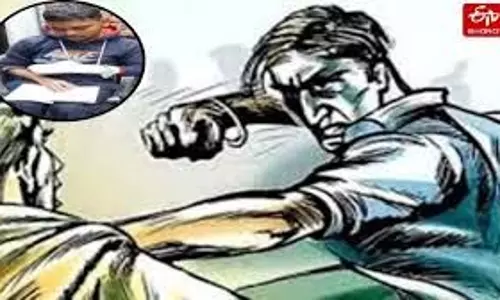 Pilibhit:मूंगफली के पैसे मांगने पर दबंग ने तोड़ दी दुकानदार की अंगुली Pilibhit:मूंगफली के पैसे मांगने पर दबंग ने तोड़ दी दुकानदार की अंगुली