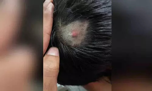 Zahirabad में प्राइवेट स्कूल के टीचर पर छात्र को पीटने का आरोप