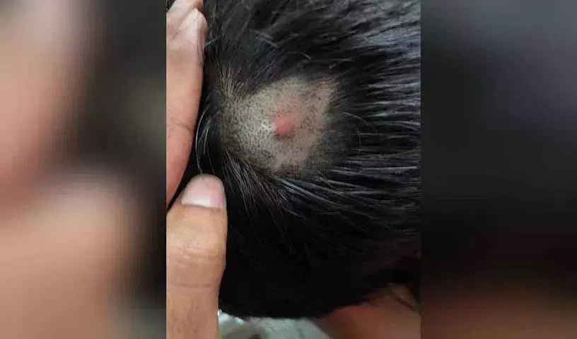 Zahirabad में प्राइवेट स्कूल के टीचर पर छात्र को पीटने का आरोप Zahirabad में प्राइवेट स्कूल के टीचर पर छात्र को पीटने का आरोप