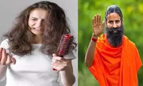 Baba Ramdev :बाल झड़ने की दिक्कत का कर रहे हैं सामना, बाबा रामदेव ने बताए घरेलू उपाय