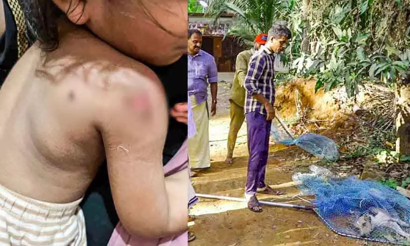 Kerala : गलियों में आतंक फैलाते कुत्ते Kerala : गलियों में आतंक फैलाते कुत्ते