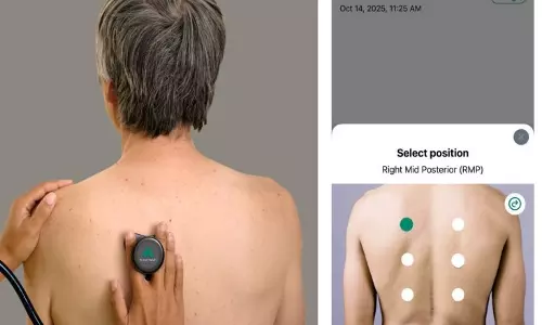 AI-पावर्ड डिजिटल स्टेथोस्कोप स्क्रीनिंग गैप को पाटने में उम्मीद