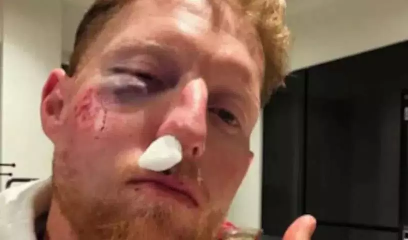 ट्रेनिंग सेशन के दौरान चेहरा फ्रैक्चर हुआ.. Ben Stokes गंभीर रूप से घायल ट्रेनिंग सेशन के दौरान चेहरा फ्रैक्चर हुआ.. Ben Stokes गंभीर रूप से घायल