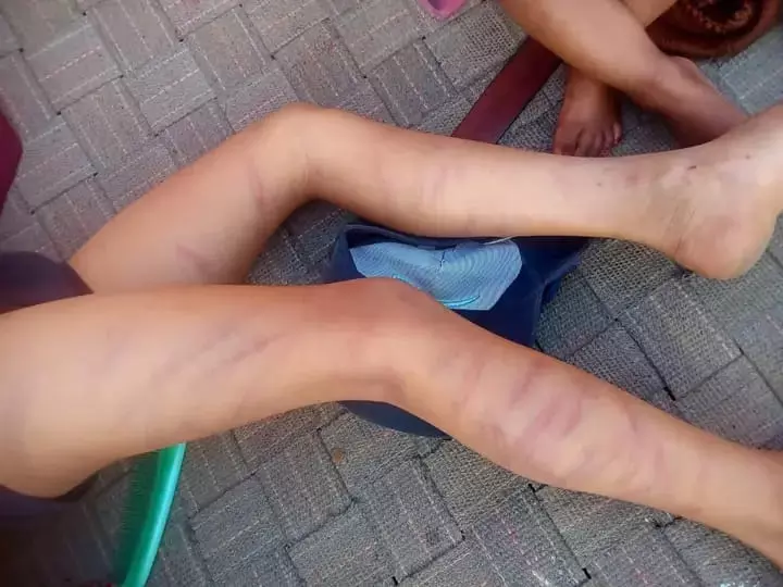 Homework न करने की मिली हैवानियत भरी सज़ा! Homework न करने की मिली हैवानियत भरी सज़ा!