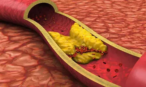 घर पर बने ड्रिंक्स जो आपकी arteries को साफ करने में मदद कर सकते घर पर बने ड्रिंक्स जो आपकी arteries को साफ करने में मदद कर सकते