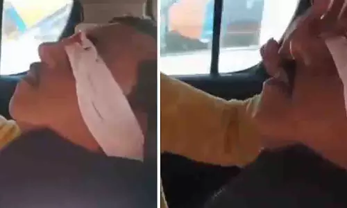 Lucknow में सड़क हादसे का वीडियो: बुजुर्ग का चेहरा चीनी मांझे से घायल