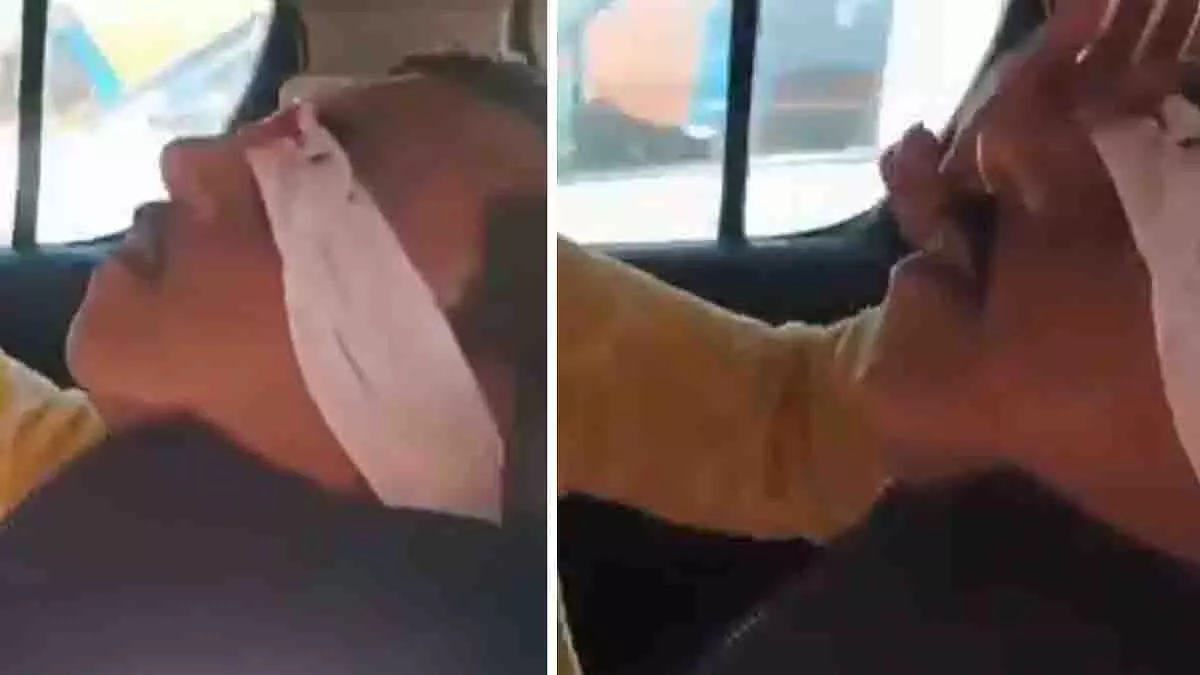 Lucknow में सड़क हादसे का वीडियो: बुजुर्ग का चेहरा चीनी मांझे से घायल Lucknow में सड़क हादसे का वीडियो: बुजुर्ग का चेहरा चीनी मांझे से घायल