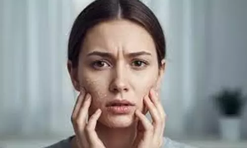 Skincare Tips:  रूखी  त्वचा खिंची हुई लग रही है, अपनाएं ये आसान और असरदार तरीके