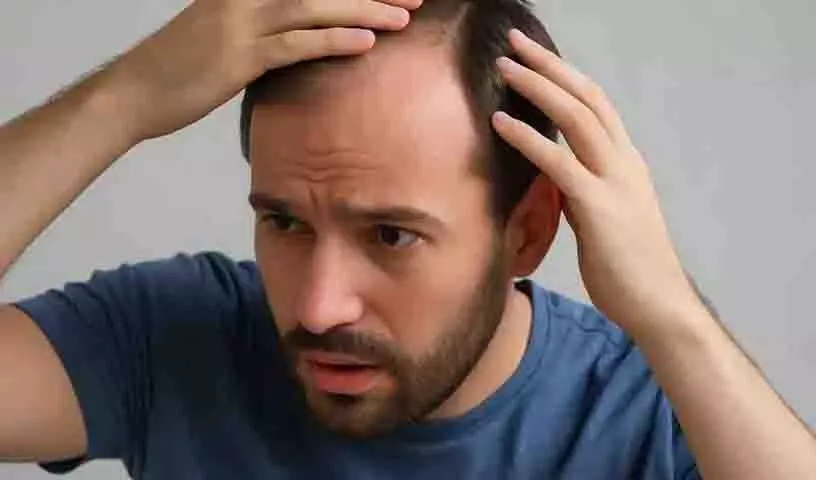 पुरुषों में Hair Fall के क्या कारण हैं? क्या करें? पुरुषों में Hair Fall के क्या कारण हैं? क्या करें?