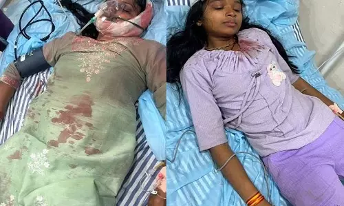 मेले में बड़ा हादसा: आकाश झूला टूटकर गिरा, दो युवतियां गंभीर रूप से घायल