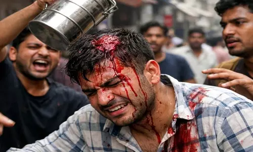 रायपुर: टिफिन के विवाद में युवक के सिर को फोड़ा