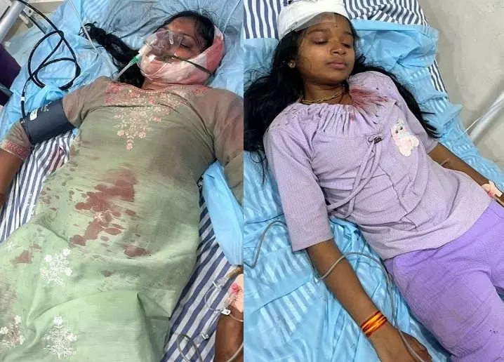 मेले में बड़ा हादसा: आकाश झूला टूटकर गिरा, दो युवतियां गंभीर रूप से घायल मेले में बड़ा हादसा: आकाश झूला टूटकर गिरा, दो युवतियां गंभीर रूप से घायल