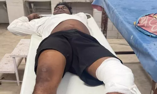 Bhubaneswar: ट्रांसजेंडर हत्या के आरोपी का पुलिस मुठभेड़ में सामना