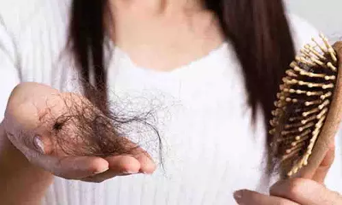 Winter में बाल झड़ते हैं, ये हैं इसके मुख्य कारण Winter में बाल झड़ते हैं, ये हैं इसके मुख्य कारण