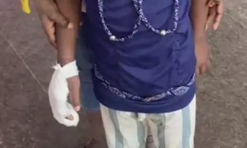 स्कूल में छात्रा की उंगली कटने पर बीईओ और शिक्षकों के खिलाफ FIR