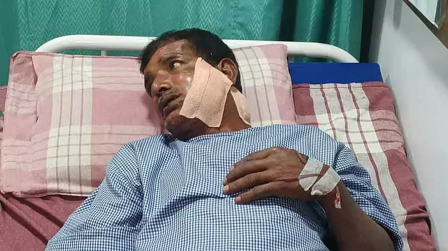 Karnataka : तेंदुए के हमले में पशुपालक घायल Karnataka : तेंदुए के हमले में पशुपालक घायल