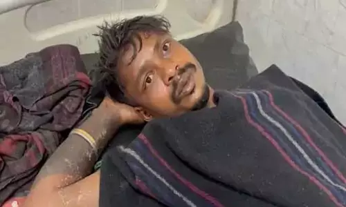 गर्लफ्रेंड की जगह उसका भाई आया मुलाकात की जगह में, पेट्रोल से जिंदा जलाने की कोशिश