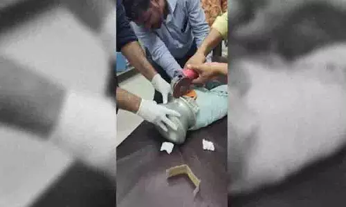 Jalgaon में डॉक्टर और प्लंबर ने 12 मिनट के कट-आउट ऑपरेशन के बाद लड़के को मुक्त कराया Jalgaon में डॉक्टर और प्लंबर ने 12 मिनट के कट-आउट ऑपरेशन के बाद लड़के को मुक्त कराया