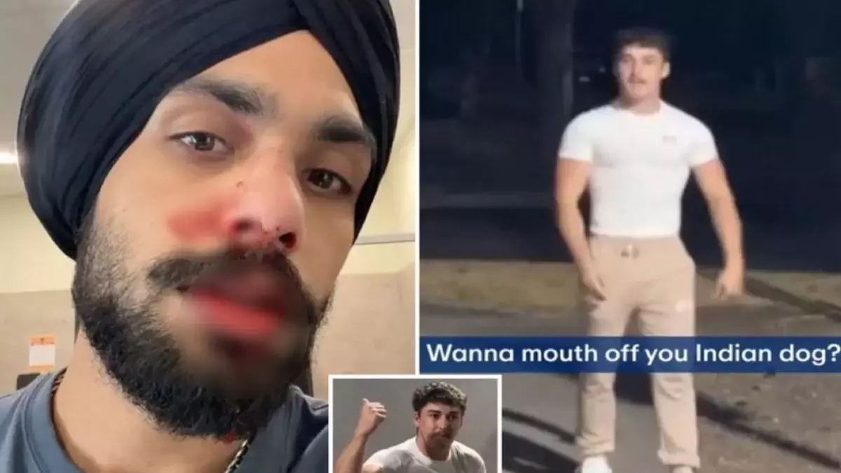 Australia के मेलबर्न जिम के बाहर नस्लवादी हमले में नर्स की नाक टूट गई