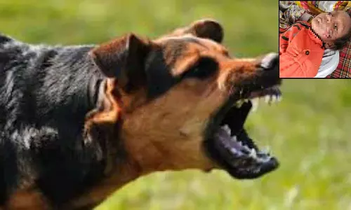 MP : छतरपुर में आवारा कुत्ते ने 4 साल के बच्चे पर बेरहमी से हमला किया MP : छतरपुर में आवारा कुत्ते ने 4 साल के बच्चे पर बेरहमी से हमला किया