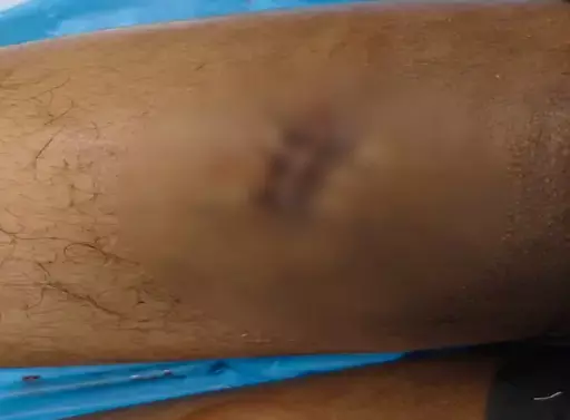 लड़की के लिए लड़ाई, आजाद चौक इलाके में चाकूबाजी लड़की के लिए लड़ाई, आजाद चौक इलाके में चाकूबाजी