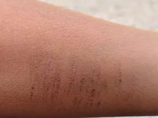 मीडिल स्कूल में चौंकाने वाली घटना: 35 बच्चों ने ब्लेड, पिन और कांटों से काटे हाथ मीडिल स्कूल में चौंकाने वाली घटना: 35 बच्चों ने ब्लेड, पिन और कांटों से काटे हाथ
