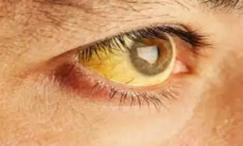 रायपुर के इस हॉस्टल में फैली पीलिया, 12 छात्राएं चपेट में रायपुर के इस हॉस्टल में फैली पीलिया, 12 छात्राएं चपेट में