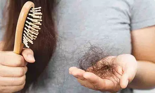 Hair Fall के क्या कारण हैं और हमें कौन से खाद्य पदार्थ खाने चाहिए Hair Fall के क्या कारण हैं और हमें कौन से खाद्य पदार्थ खाने चाहिए