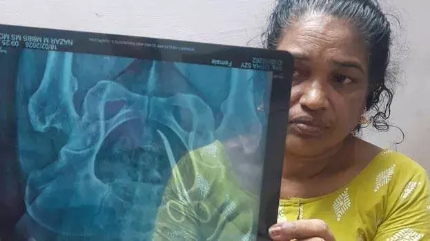 kerala: वंदनम मेडिकल कॉलेज में सर्जिकल गलती; डॉक्टर जे. शाहिदा और नर्स सस्पेंड