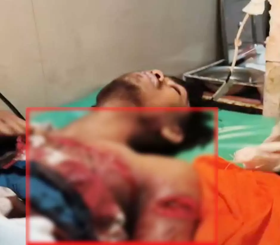 लिफ्ट मांगने के बहाने युवक पर कटर से जानलेवा हमला, देखें VIDEO... लिफ्ट मांगने के बहाने युवक पर कटर से जानलेवा हमला, देखें VIDEO...