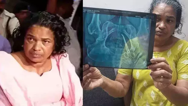 Kerala: सर्जरी में गलती का पता लगाने के लिए केस शीट अब कस्टडी में