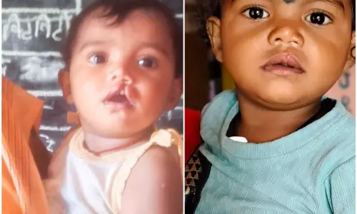 चिरायु दल ने लौटाई मासूम रंजना की मुस्कान चिरायु दल ने लौटाई मासूम रंजना की मुस्कान