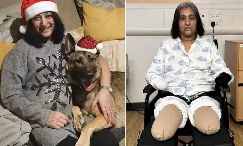 कुत्ते के चाटने के 2 दिन बाद UK में पंजाबी मूल की महिला कोमा में चली गई, उसके सारे हाथ-पैर निकाल दिए गए