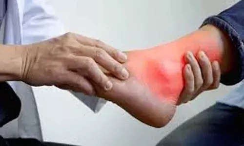 शरीर में बढ़ा हुआ Uric Acid खतरनाक है, इसे ऐसे कंट्रोल करें शरीर में बढ़ा हुआ Uric Acid खतरनाक है, इसे ऐसे कंट्रोल करें