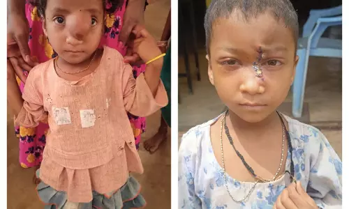 पिता के साये और आर्थिक तंगी के बीच चिरायु योजना बनी सहारा, अंजलि को मिला नया जीवन