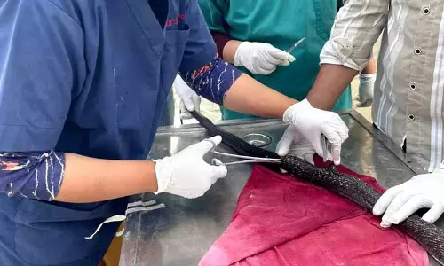 ऊना में JCB मशीन की चपेट में आने से घायल किंग कोबरा की सर्जरी हुई ऊना में JCB मशीन की चपेट में आने से घायल किंग कोबरा की सर्जरी हुई