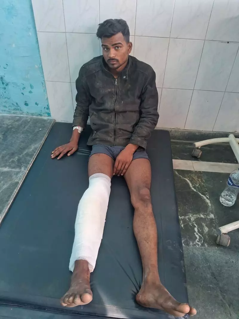 Gurugram में छोटी मुठभेड़ के बाद वांछित अपराधी पकड़ा गया Gurugram में छोटी मुठभेड़ के बाद वांछित अपराधी पकड़ा गया
